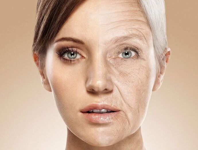 koža lica prije i nakon laserskog podmlađivanja